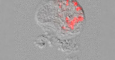 Thecofilosea amoeba con i batteri all'interno